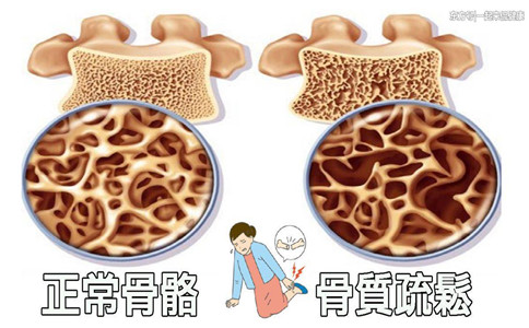 國產骨密度儀生產廠家